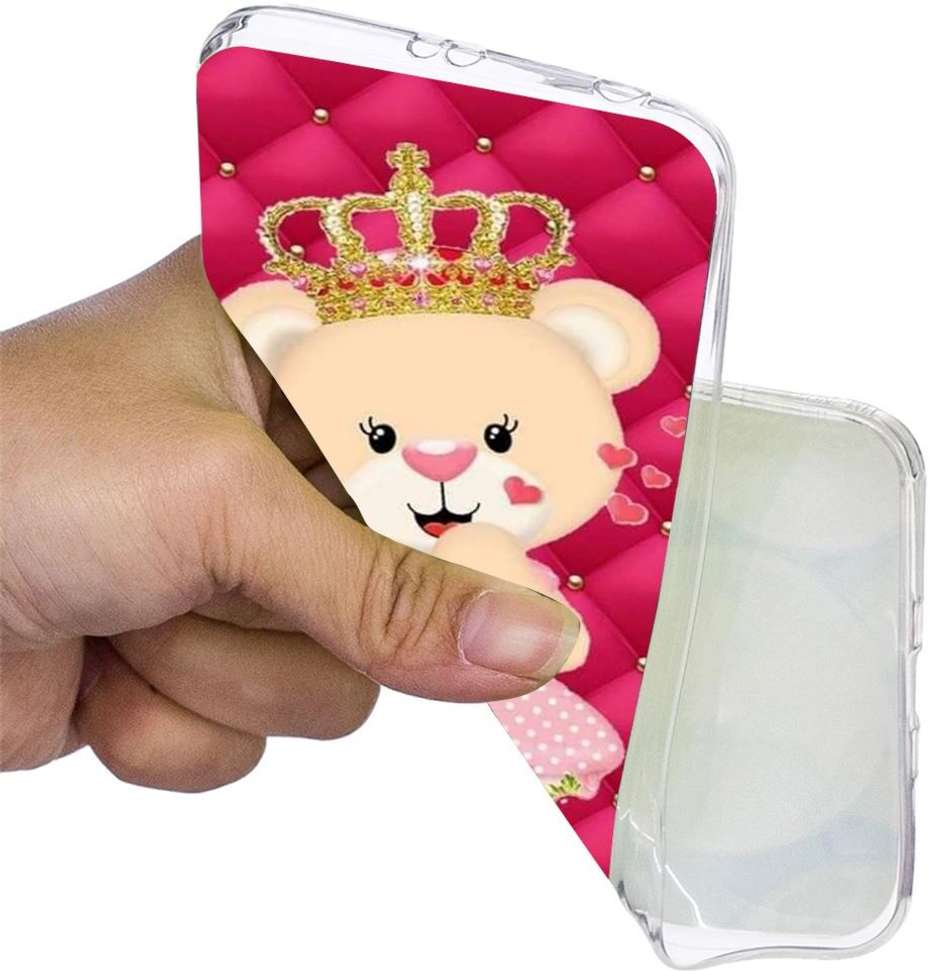 Image Placeholder