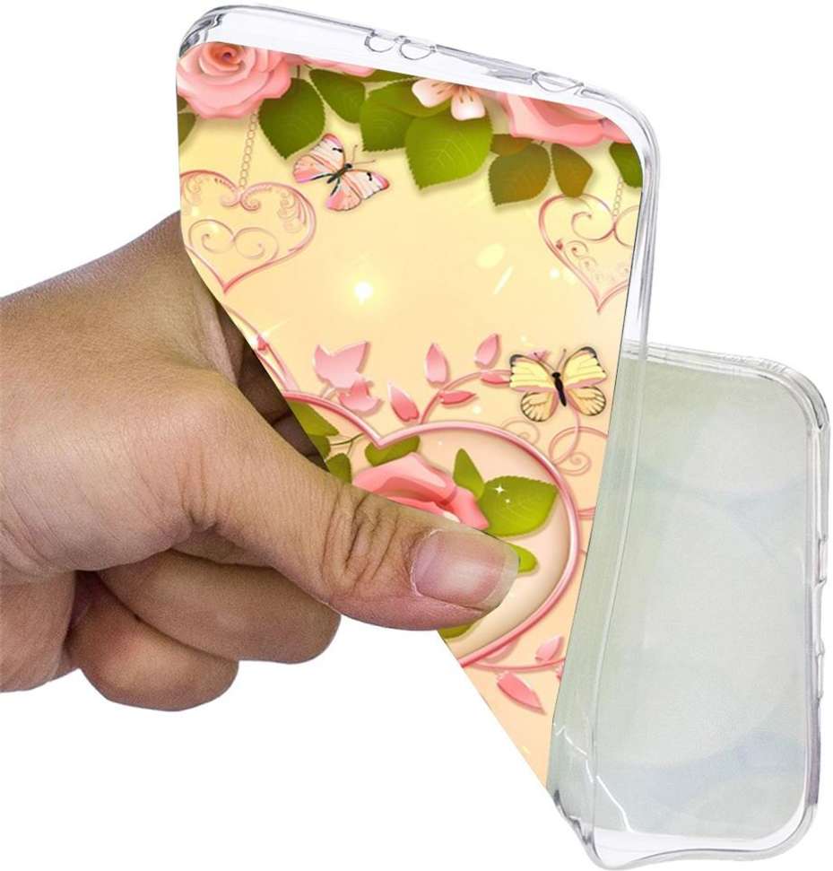 Image Placeholder