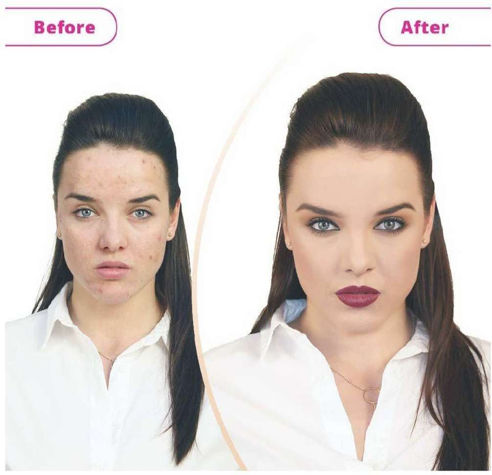 Image Placeholder