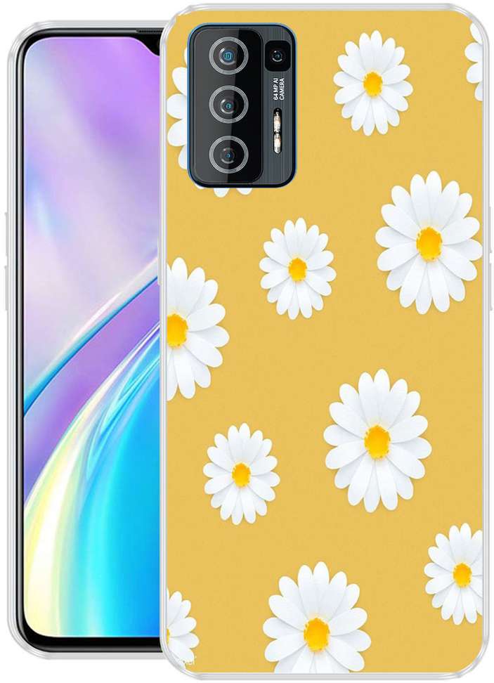 Image Placeholder