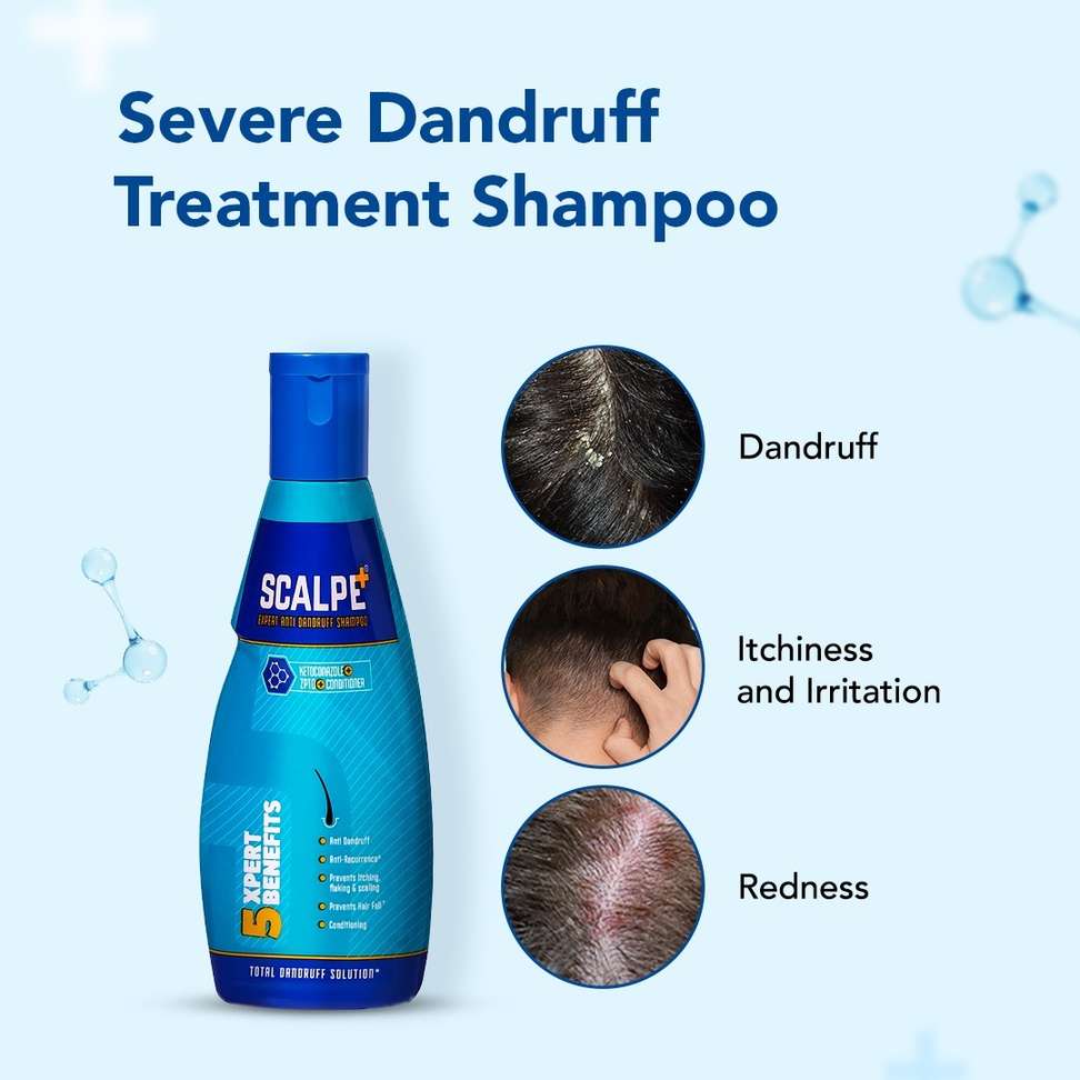Shopsy Scalpe Plus Anti Dandruff Shampoo Liquid - Image 3