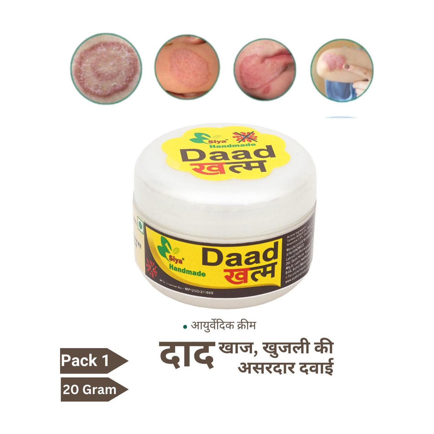 Siya Daad Khatam Anti-Fungal Cream â Handmade & Natural (20 g) - Image 1