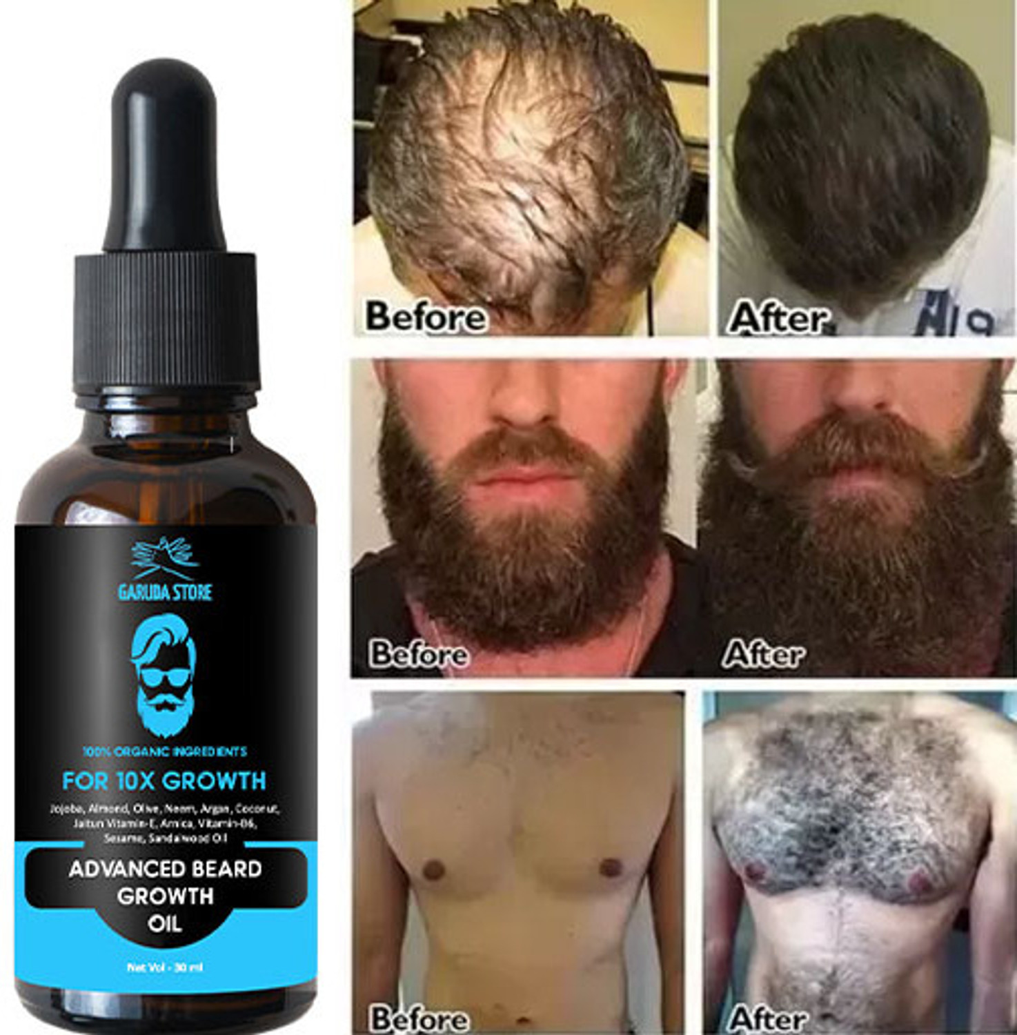 Garuda Store Beard and Hair Growth Oil Promotes Beard Growth and Thickens Beard Hair Oil (30 ml) - Image 1