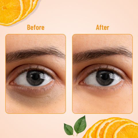 SWISS BEAUTY Hydra Eye Serum Patch for Nourishment | Anti-wrinkle