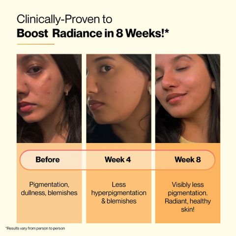 SETU Skin Renew Glutathione 500mg Tablets with Vitamin C | Orange Flavour Price in India - Buy SETU Skin Renew Glutathione 500mg Tablets with Vitamin C