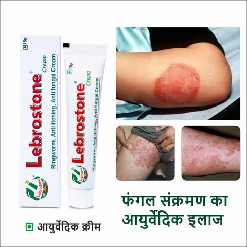 Lebrostone Ayurvedic Skin Ointment 15g for Ringworm & Fungal Infection - Image 8