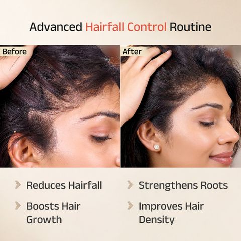 Vedix Keshamrut Kit: Oil, Shampoo & Serum - Image 6