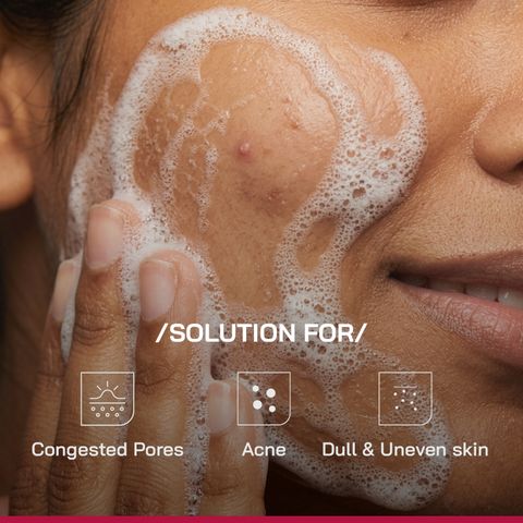 Proven Honest Derma 2% Salicylic Acid Gel for Oily & Acne-Prone Skin Face Wash (100 g) - Image 7