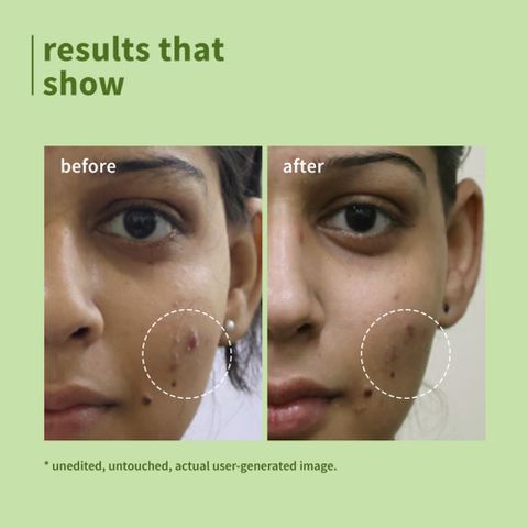 Plum Green Tea Pore Cleanser For Oily, Acne-Prone Skin | Fights Pimples | Non-Drying |Men and Women Face Wash (50 ml) - Image 4
