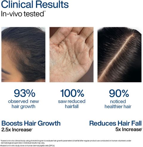 WishCare Foaming Hair Growth Serum 50ml - Image 4