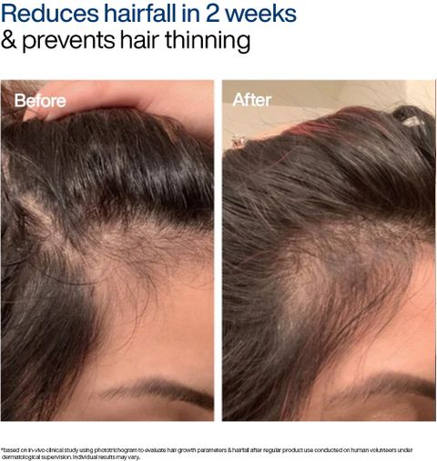 WishCare Foaming Hair Growth Serum 50ml - Image 6