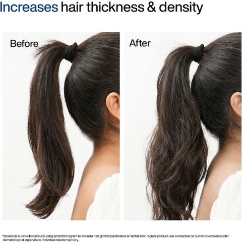 WishCare Foaming Hair Growth Serum 50ml - Image 8