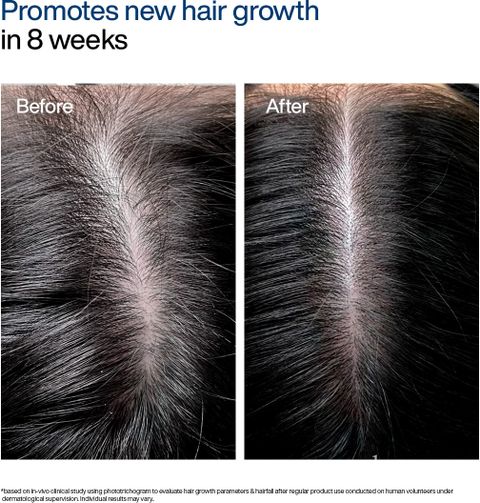 WishCare Foaming Hair Growth Serum 50ml - Image 7