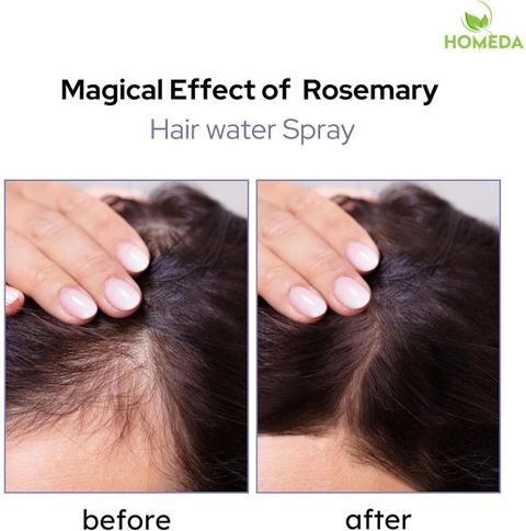 Homeda Rosemary Water for Hair Growth, Rose mary water spray Rose marry Rose Merry Mist (400 ml) - Image 7