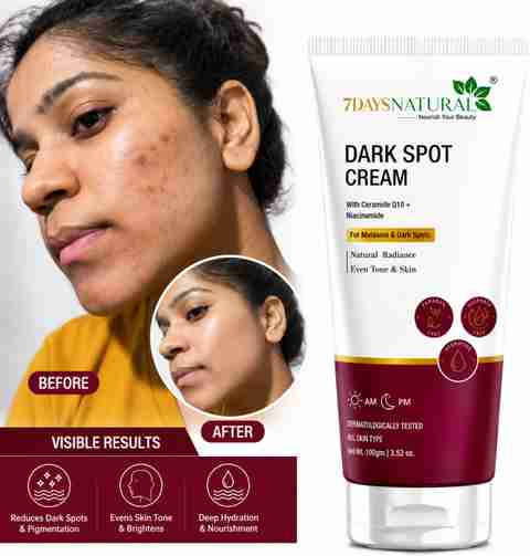 7 Days Dark Spot Remover Cream 100g - Image 3