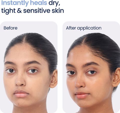 WishCare 3:1:1 Barrier Bounce Moisturiser 50ml - Image 5