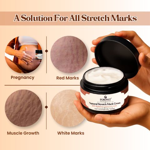 Pokonut Stretch Mark Repair Combo, Cream & Roll-On Serum (100 g) - Image 8