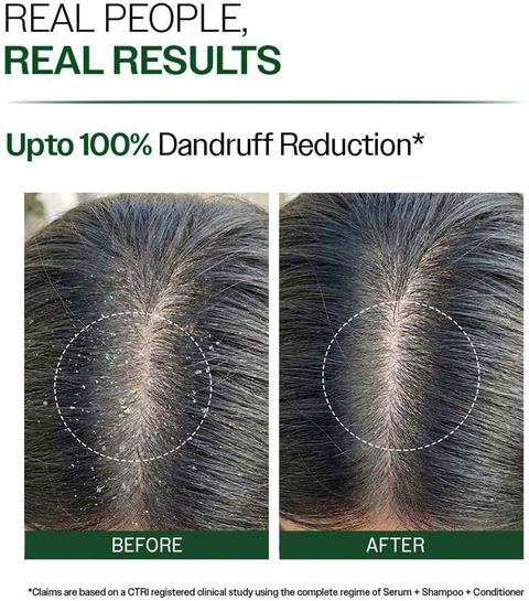 BARE ANATOMY Anti-Dandruff Shampoo - Upto 100% Dandruff Reduction with Salicylic Acid, Biotin (100 ml) - Image 4