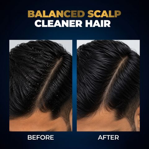 BEARDO Studio Professional Scalp Balance Shampoo for Dandruff (200 ml) - Image 6