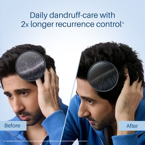 Scalpe Pro Daily Anti-Dandruff Shampoo 100ml - Image 7