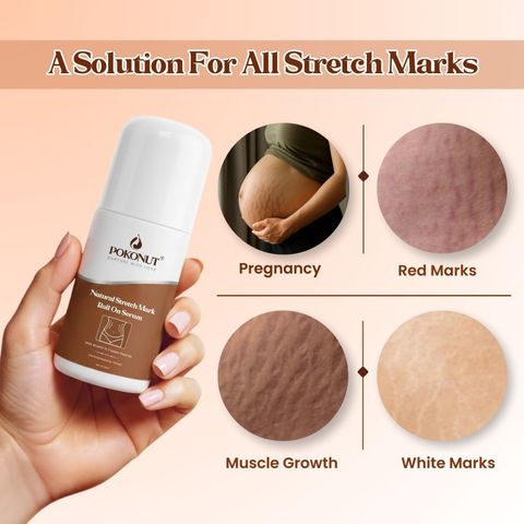 Pokonut Stretch Mark Repair Combo, Cream & Roll-On Serum (100 g) - Image 6