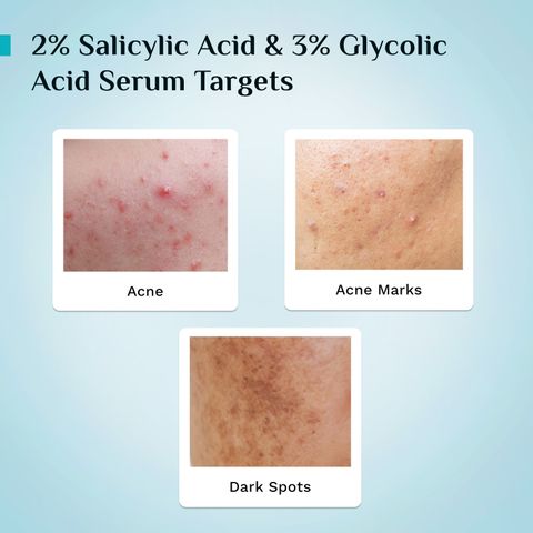 Pilgrim Salicylic Acid 1% + Glycolic Acid 3% Anti Acne Serum, 30ml - Image 6