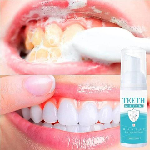 Qwera Cleaning Teeth Whitening Mousse Foam Toothpaste Oral Hygiene Effective - mint (50 ml) - Image 6