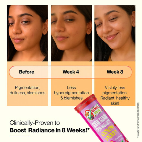 glutathione whitening pills before and after Skin Pills- For Skin Whitening?? Glutathione Tablets Before and After: