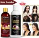 Garuda Store Advanced Beard Care Oil Kit with 0.5 mm Derma Roller for Men (1 Items in the set) - Image 4