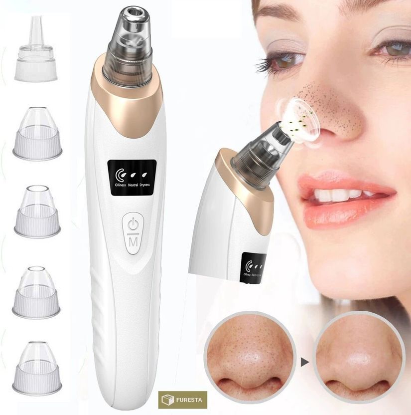 FURESTA Blackhead Remover Vacuum Suction Device - Image 3
