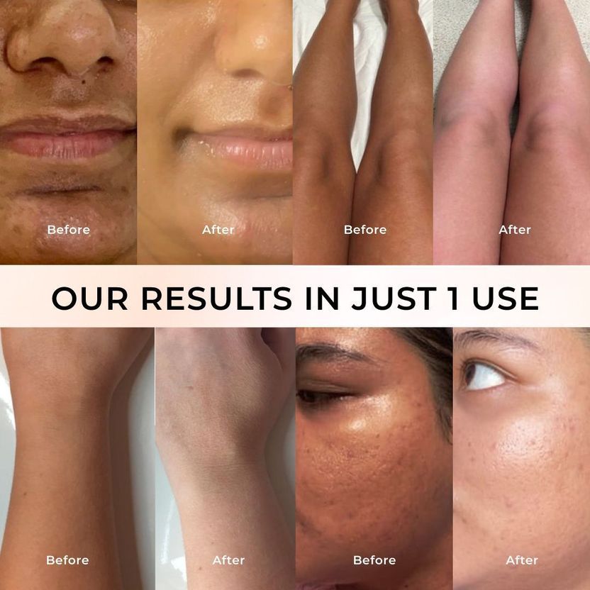 Niconi Gluta-Kojic Instant Tan Removal - Image 5