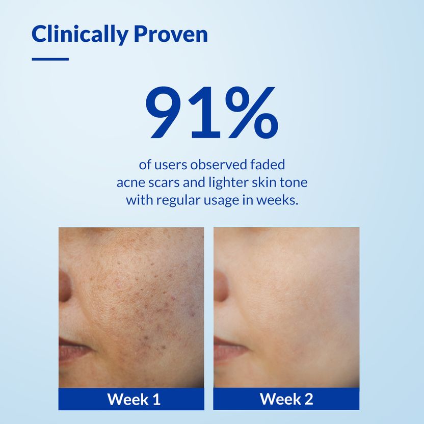 Fixderma Skarfix TX Cleanser 75g - Image 5