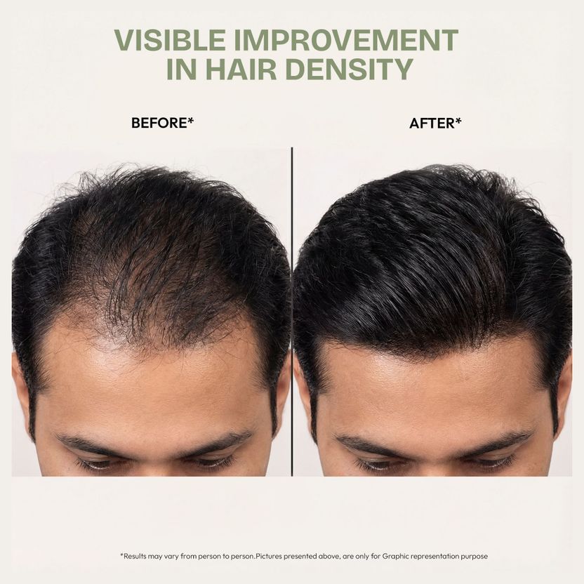 Proskire Ultimate Hair Growth Oil 100ml - Image 4