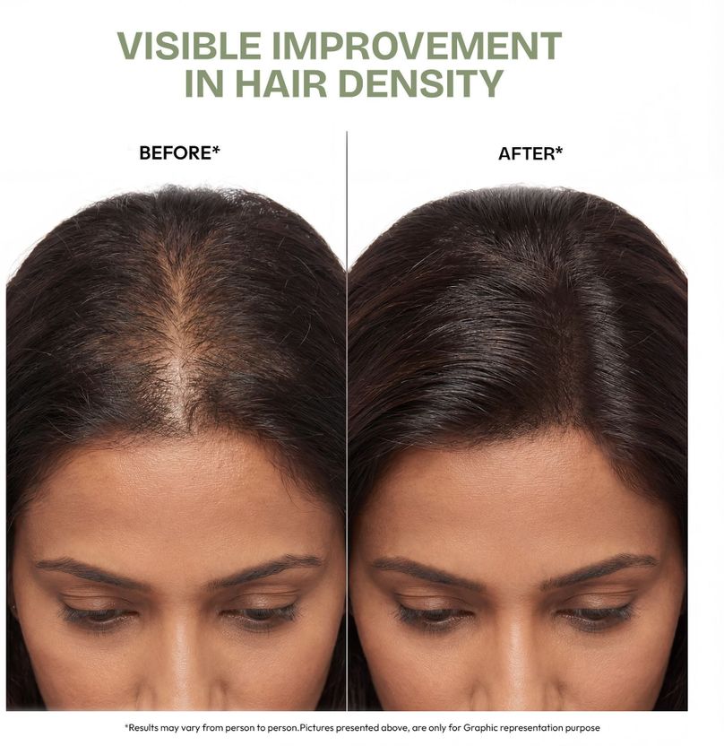 Proskire Ultimate Hair Growth Oil 100ml - Image 3