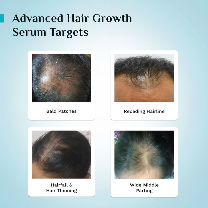 Pilgrim Advance Hair Growth Serum 30ml - Image 7