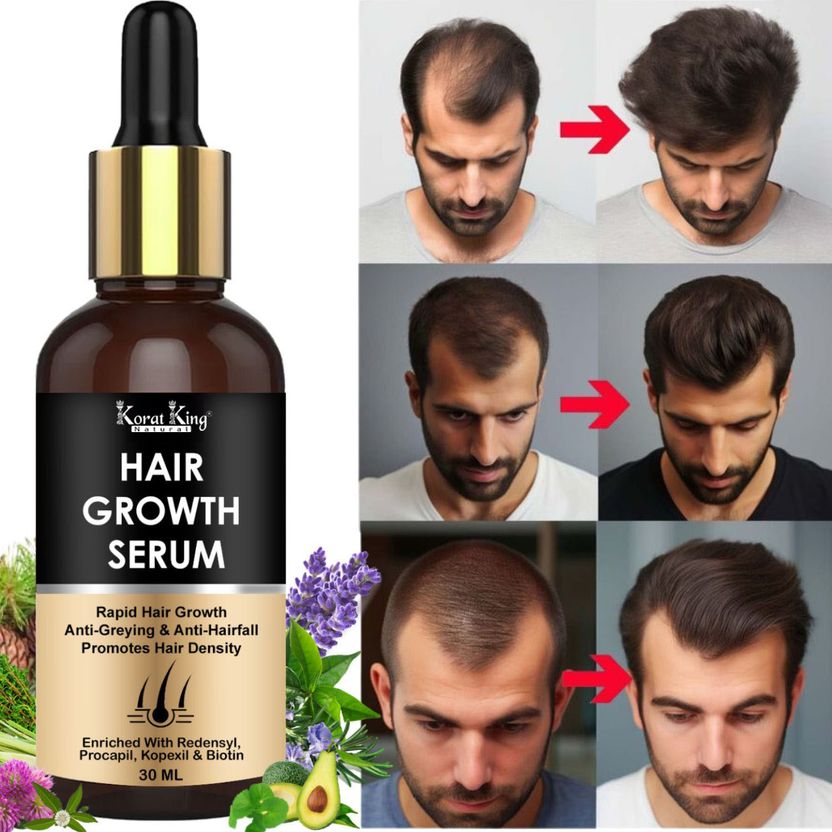 KORAT KING Hair Growth Serum 3% Redensyl - Image 3