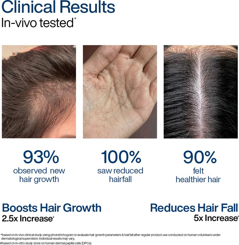 WishCare Hair Growth Serum 30ml - Image 4