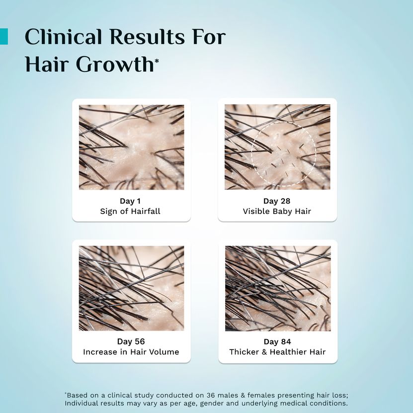 Pilgrim Advance Hair Growth Serum 30ml - Image 10