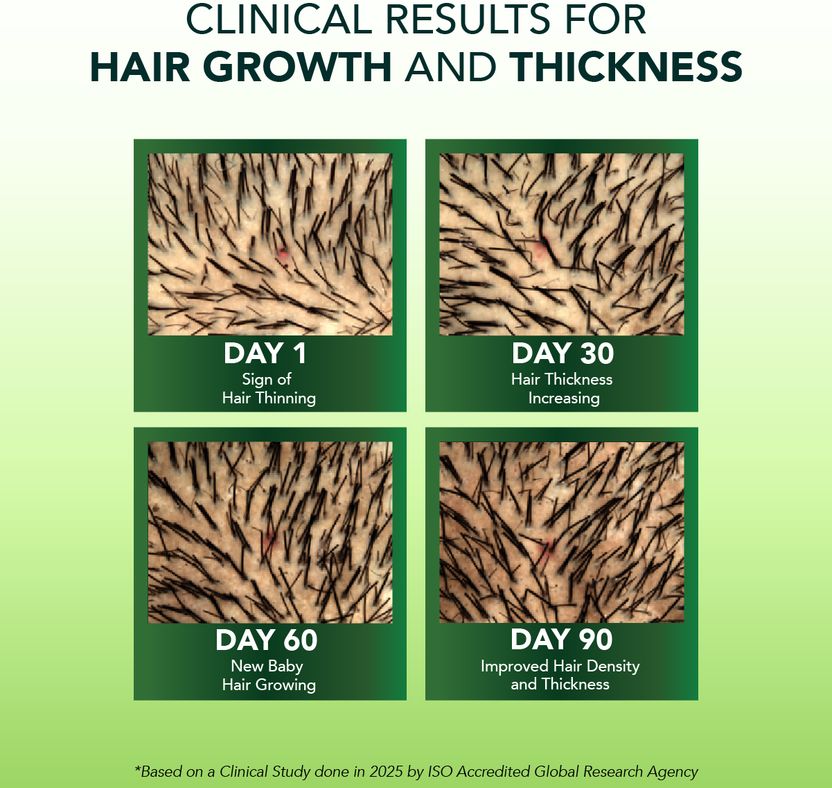 Alps Goodness Rosemary Water Hair Spray - Image 5