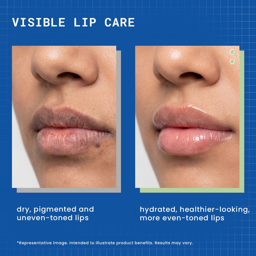 Dermdoc LipBright Treatment Lip Balm - Image 2