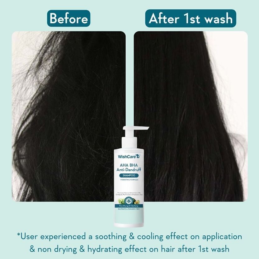 WishCare Hydrating Anti Dandruff Shampoo 120 ml - Image 5