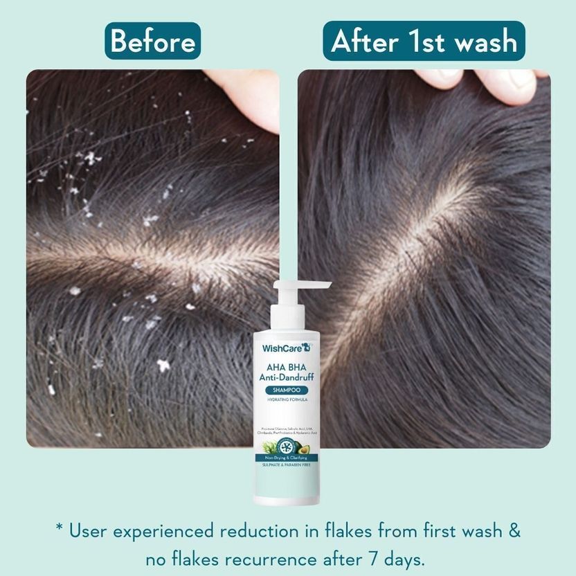WishCare Hydrating Anti Dandruff Shampoo 120 ml - Image 4