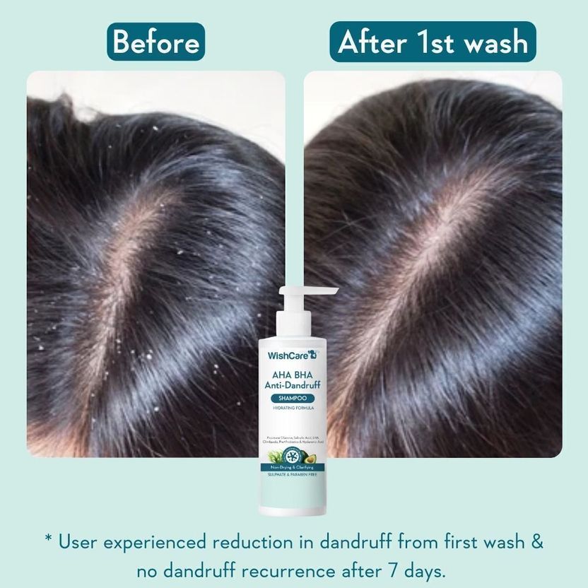 WishCare Hydrating Anti Dandruff Shampoo 120 ml - Image 3