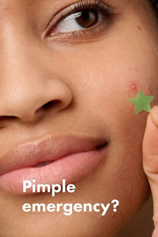 imelda Acne Pimple Patch For Covering Zits - Image 5