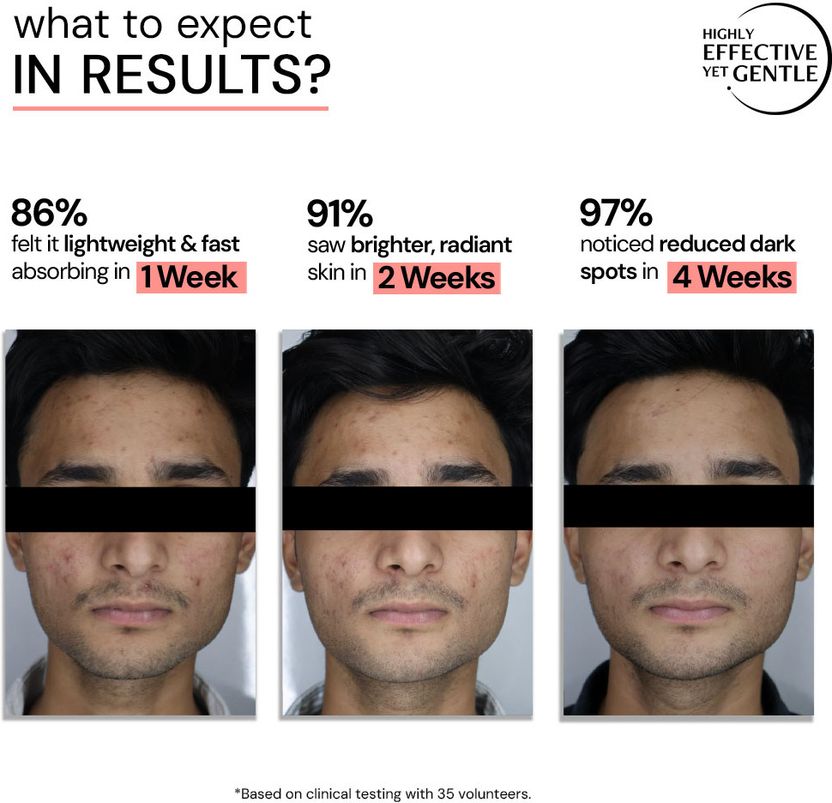 Deconstruct 5% Niacinamide + 2% Alpha Arbutin Serum 30ml - Image 7