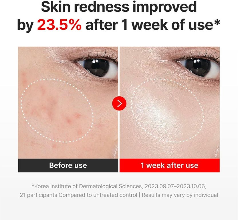 Centellian 24 Madeca Cream Time Reverse Firming Face Moisturizer - Image 3
