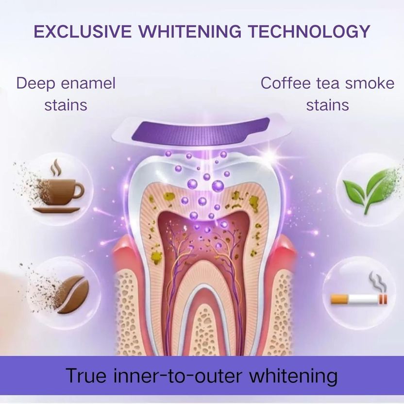 RJD1114 Teeth Whitening Strips with PAP - Image 4
