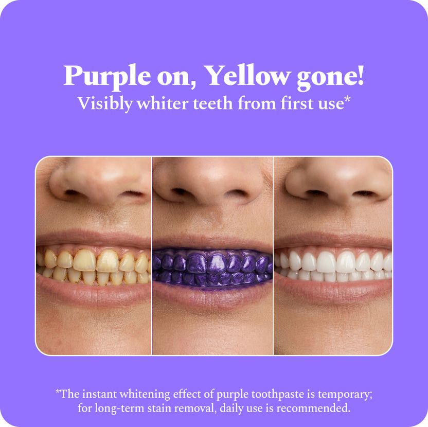Perfora Purple Whitening Toothpaste - Image 4