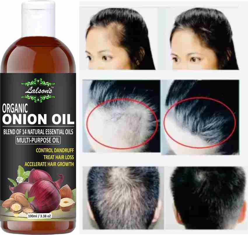 Natural oils for hair growth hotsell