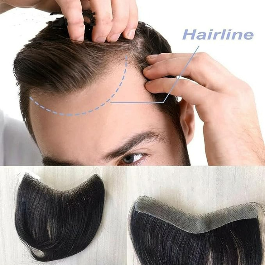 Hair Direct